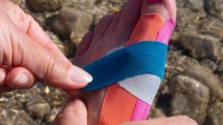 Kinesiotape bei Hallux Valgus anbringen