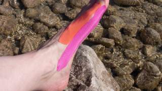 Kinesiotape bei Hallux Valgus anbringen