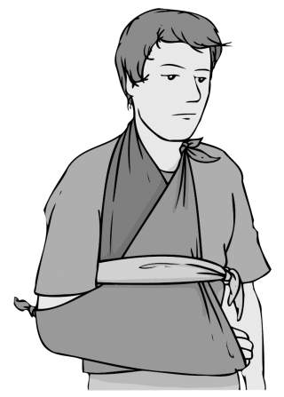 Illustration einer Armtrageschlinge