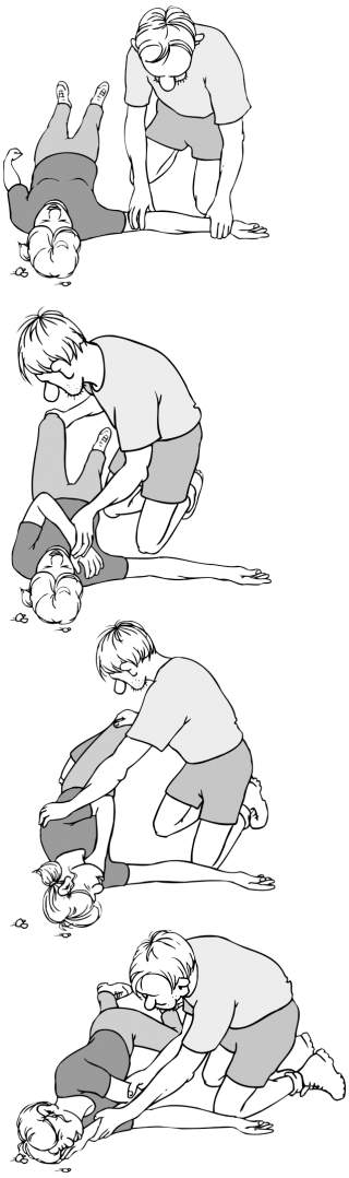 Illustration der Durchführung der stabilen Seitenalge